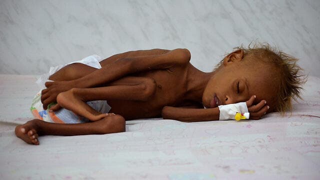 תימן, 2016. משבר הרעב שלא תם - רק מחמיר