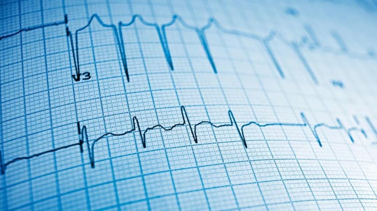 המשתתפים ששתו בממוצע כוס קפה אחת ביום חוו ירידה של 39% בהישנות של פרפור פרוזדורים לעומת אלה שנמנעו לחלוטין מקפאין (צילום: shuttetrstock) המשתתפים ששתו בממוצע כוס קפה אחת ביום חוו ירידה של 39% בהישנות של פרפור פרוזדורים לעומת אלה שנמנעו לחלוטין מקפאין