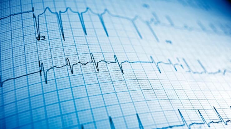 האם מערכות AI יכולות לזהות מצבים רפואיים שרופאים עשויים להחמיץ באק"ג? (צילום: shuttetrstock) האם מערכות AI יכולות לזהות מצבים רפואיים שרופאים עשויים להחמיץ באק"ג?