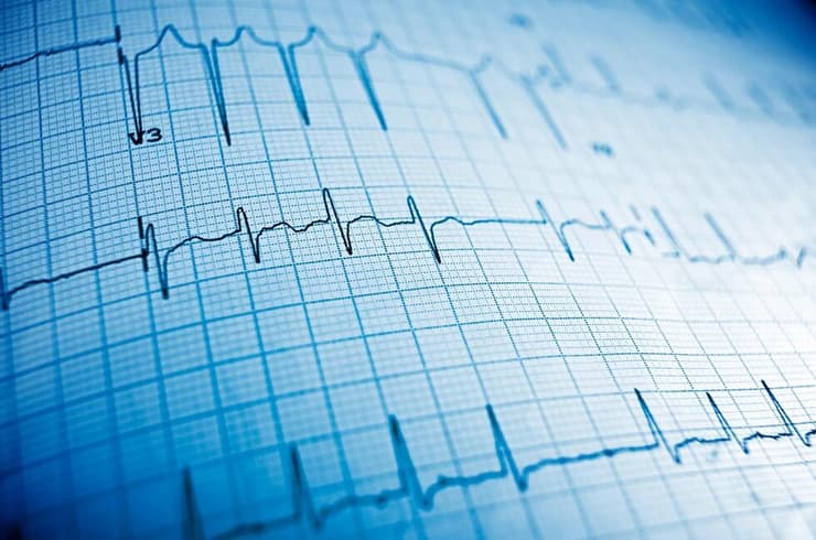 "ככל שמקדימים להגיע לקבל טיפול באנשים עם חשד להתקף לב, כך ייטב"