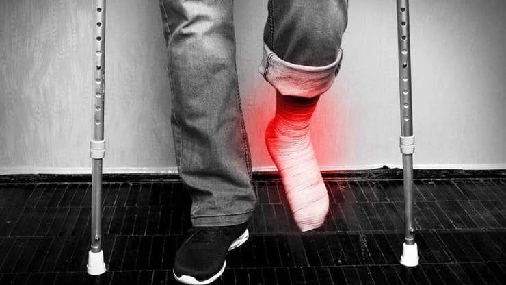 רפורמת מכשירי השיקום נתקעה. אנשים עם מוגבלויות אינם יכולים להתנייד. אילוסטרציה