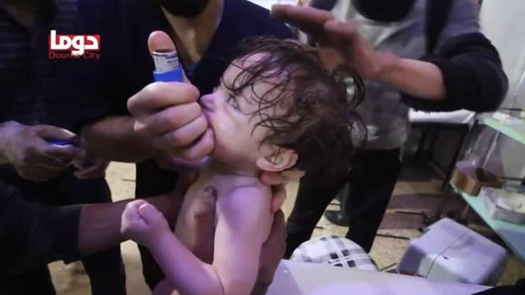 ילדים לאחר תקיפה כימית בסוריה