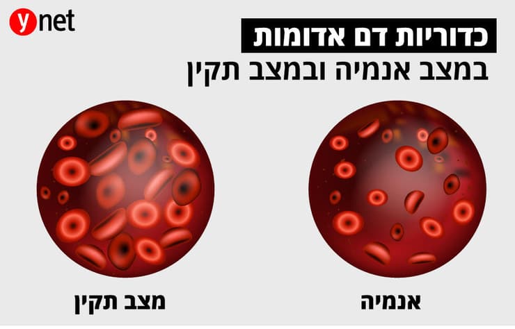 אנמיה
