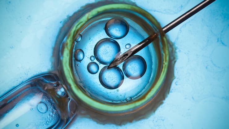 אילוס אילוסטרציה הפריה חוץ גופית