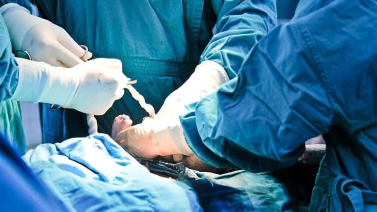 ניתוח קיסרי