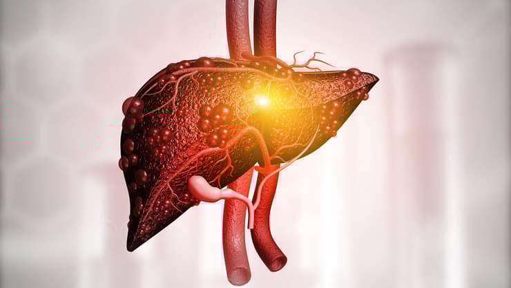 הדמייה של כבד