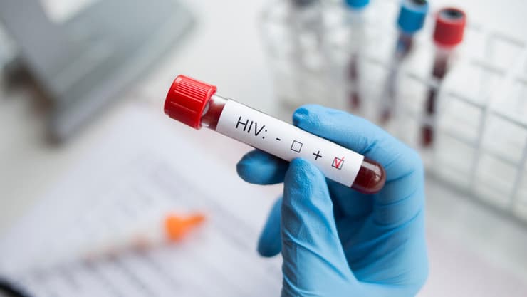 איידס HIV בדיקת דם