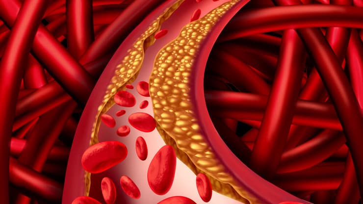 הדמיה של שומנים בדם בתלת-ממד (צילום:Shutterstock) כולסטרול