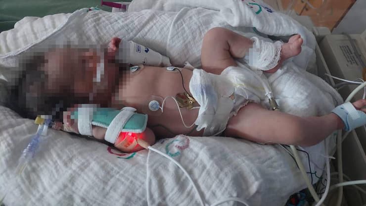 סופיה לאחר לידתה. תועבר למשפחה השנייה (באדיבות המשפחה) סופיה התינוקת מפרשת החלפת הביציות באסותא