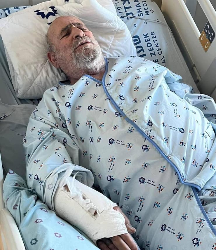 אבישר, אחרי התקיפה (באדיבות המצולם) יוסי אבישר סופר ובמאי ירושלמי הותקף על ידי אלמוני לאחר שביקש ממנו להזיז את רכבו