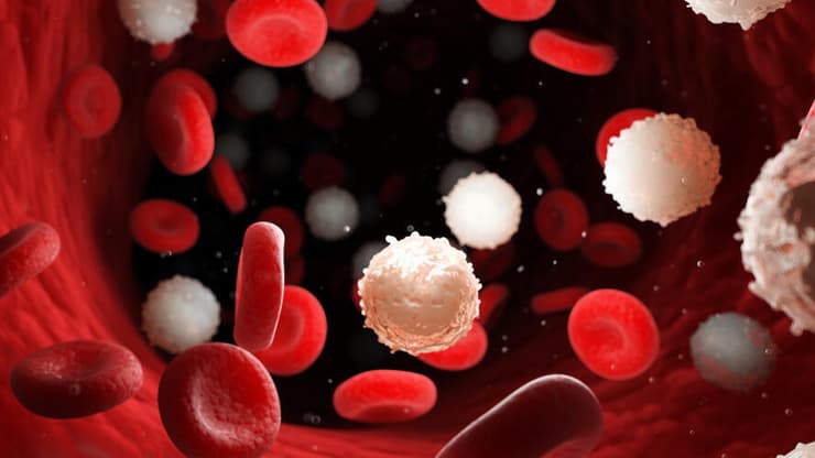 לוקמיה בהדמיית תלת ממד