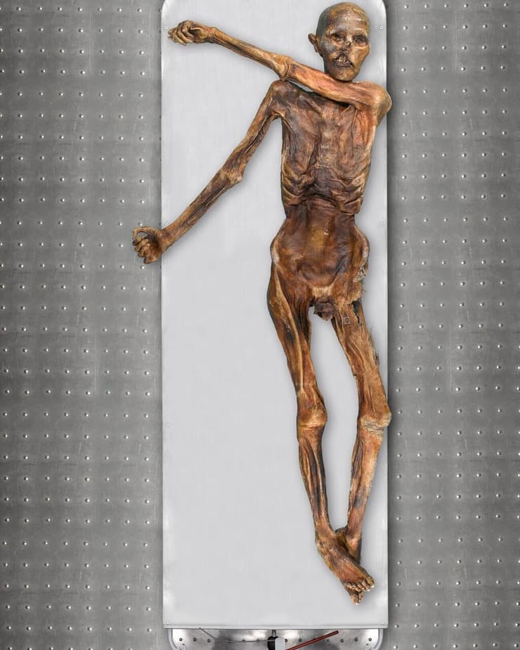 המומיה של אוצי "איש הקרח" (צילום: South Tyrol Museum of Archaeology/Eurac/Marco Samadelli-Gregor Staschitz) המומיה של אצי איש הקרח