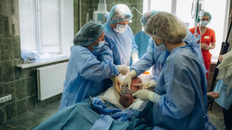 ניתוח קיסרי לידה קיסרית