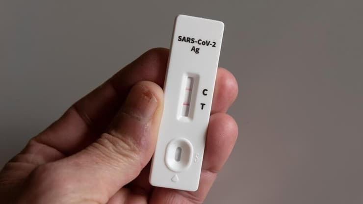 רבים אינם מדווחים על המחלה לרופאי המשפחה. אילוסטרציה (צילום: shutterstock) בדיקת קורונה