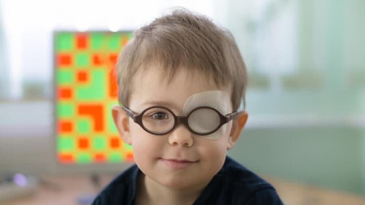 אמבליופיה עין עצלה