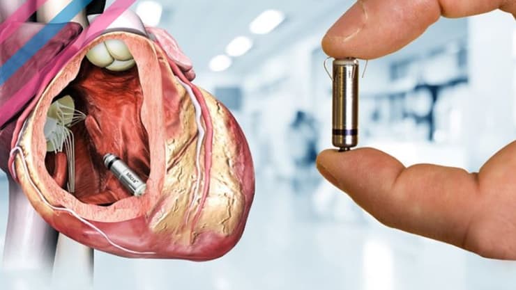 קוצב לב מיקרה הדמיה