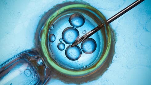 צילום: Shutterstock