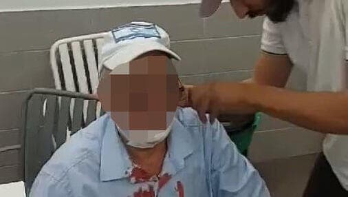  נהג האוטובוס שנפצע מנער שהשליך בקבוק זכוכית באוטובוס בלוד