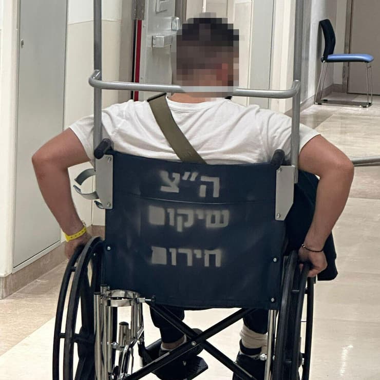 שיקום הדסה