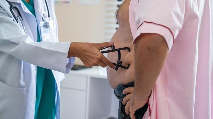 השמנה השמנת יתר מדידה באמצעות קליפר