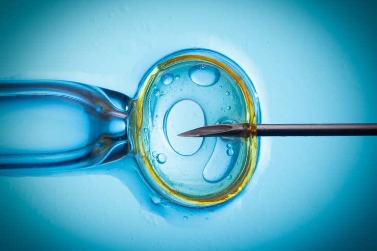 הפריה חוץ גופית IVF