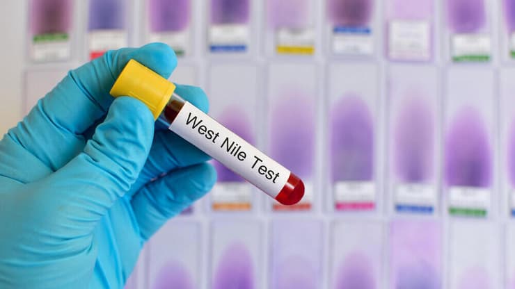 בדיקת דם קדחת מערב הנילוס