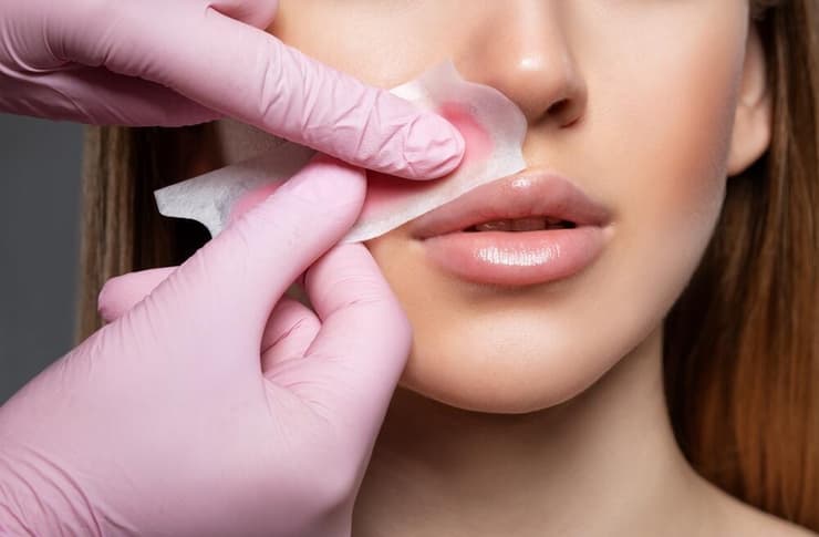 הסרת שיער שעווה פנים