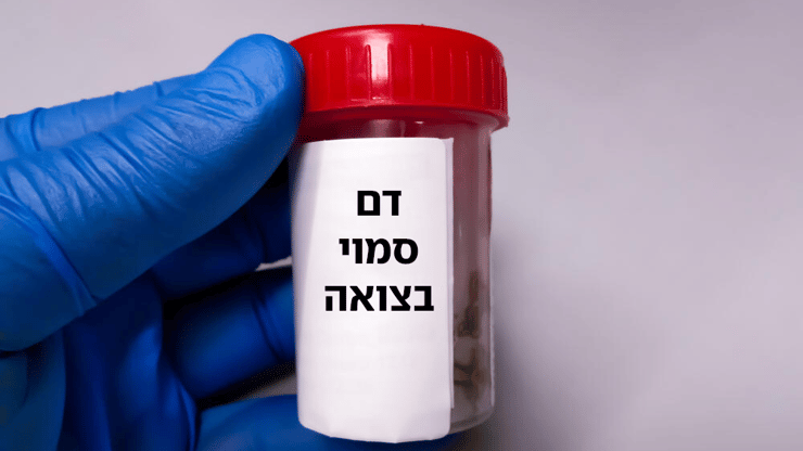 בדיקת דם סמוי בצואה