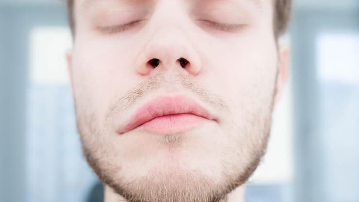 א-סימטריה בפנים בעקבות שבץ מוחי