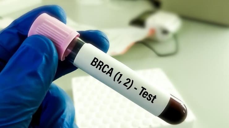 בדיקה לאיתור מוטציה בגן BRCA