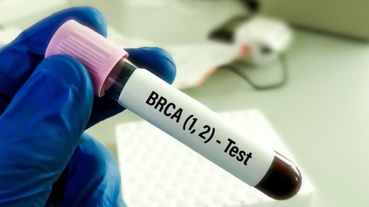 תקלה חמורה בבדיקת מוטציות בגן BRCA. אילוסטרציה (צילום: shutterstock) בדיקה לאיתור מוטציה בגן BRCA