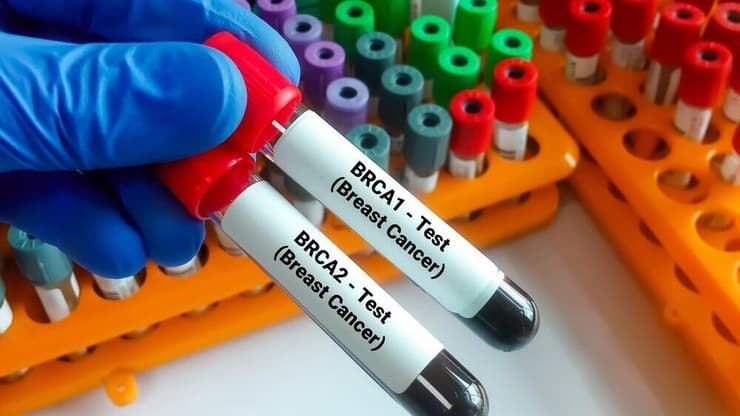 תקלה בבדיקה לאיתור מוטציה בגן BRCA. אילוסטרציה (צילום: shutterstock) בדיקה לאיתור מוטציה בגן BRCA