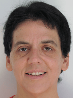 ציפי שמילוביץ 