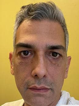 אבי שילון