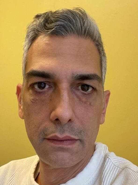 אבי שילון