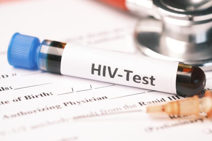 בדיקת HIV