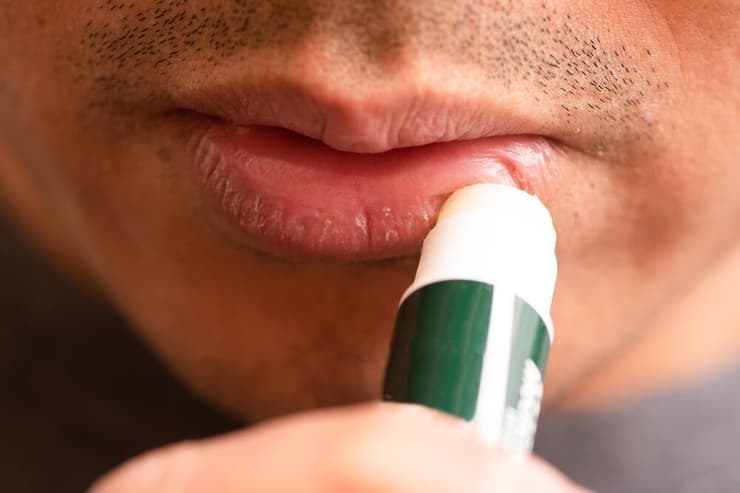 יובש בשפתיים