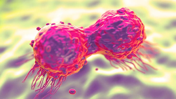 תאי סרטן השד