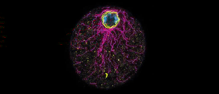 תא של Chromosphaera perkinsii