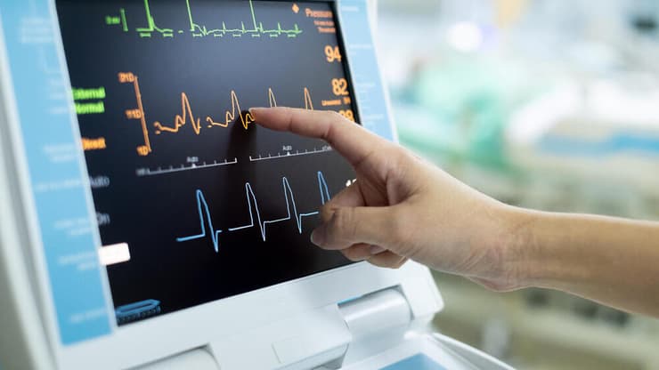 בדיקה לחולי לב