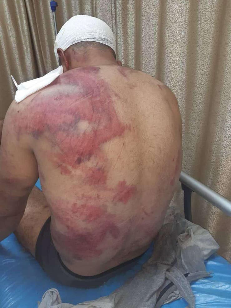 ליית' עוינה, הותקף על ידי 9 חשודים