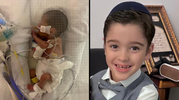 אליה סבג כיום, וביום שנולד. "סיכויי ההישרדות קלושים" אליה סבג פג