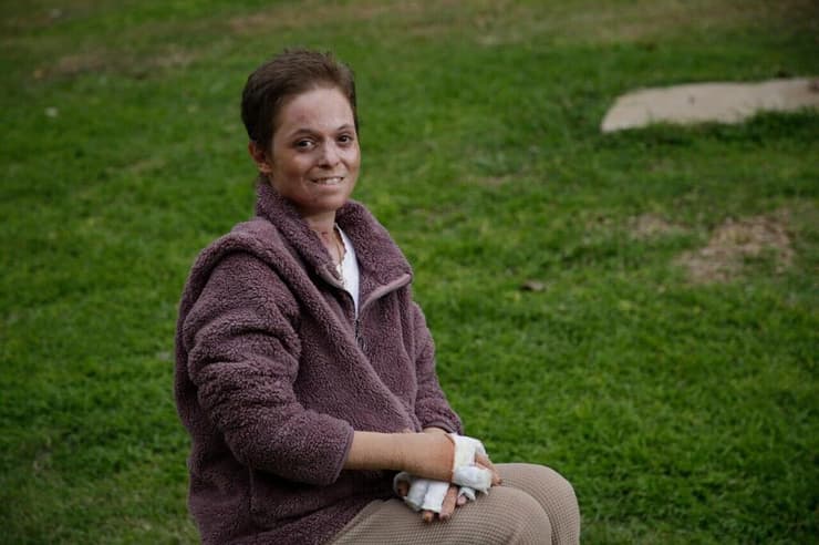 "יותם רוצה שאחייך, אני יודעת שאגיע לשם". שירון אלטר (צילום: ריאן פרויס) שירון אלטר שנפצעה בפיצוץ הקלנועית בת"א