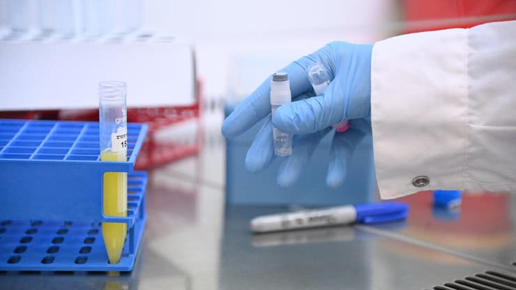 מעבדת זרע, בנק הזרע, אסותא