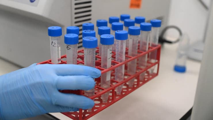 מעבדת זרע, בנק הזרע, אסותא