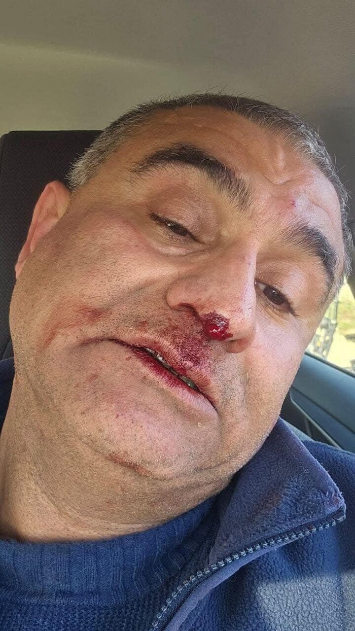 גבר תקף באופן אקראי תושב כפר קרע ופצע אותו בפניו ובידיו, המשטרה הודיעה כי החשוד "ככל הנראה ברח ממוסד רפואי לבריאות הנפש", ושהרקע לאירוע פלילי. החשוד נעצר, המשטרה ביקשה להאריך את מעצרו בבית המשפט והוא נלקח לחקירה.