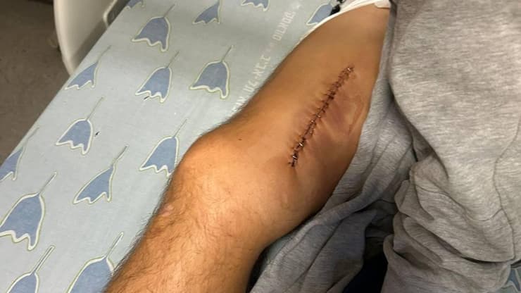 גלב שטנקוב שנדקר ברוטשילד