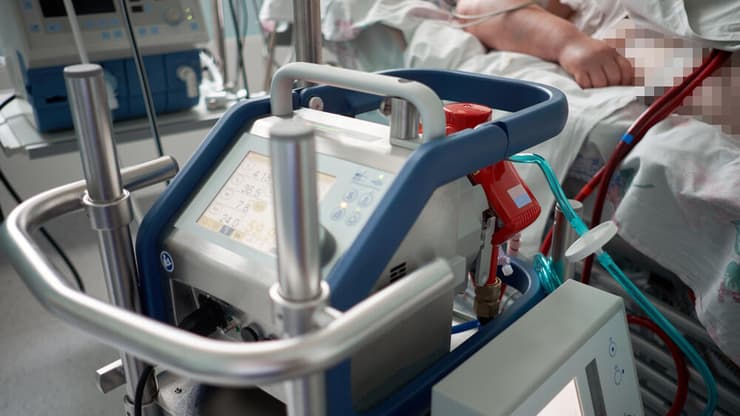 החייאה באמצעות מכשיר אקמו ECMO שמדמה פעולת לב-ריאה