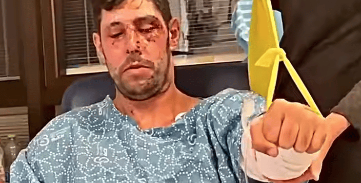 עידן עמדי בשיקום