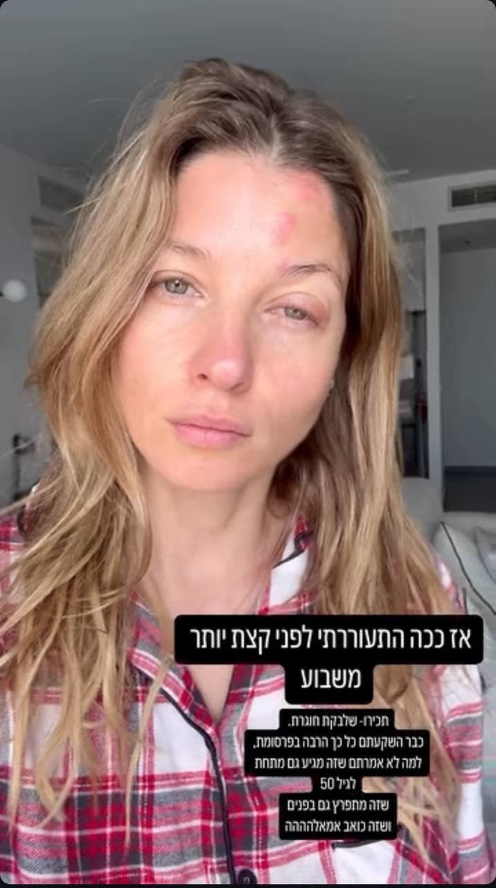 עדי הימלבלוי שלבקת חוגרת 